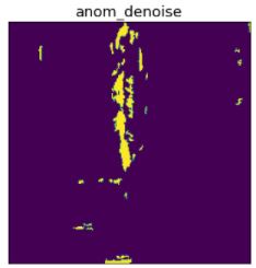 Denoised Image (nominal and anomalous)