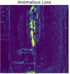 Loss Image (nominal and anomalous)