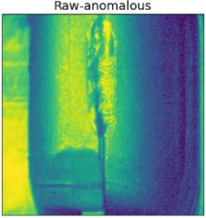 Show a raw image (nominal and anomalous)